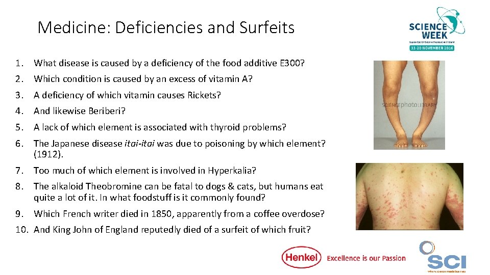 Medicine: Deficiencies and Surfeits 1. What disease is caused by a deficiency of the