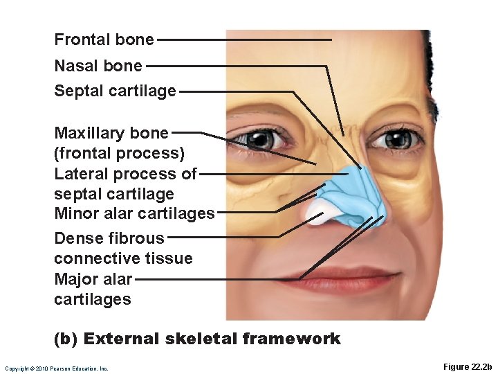 Frontal bone Nasal bone Septal cartilage Maxillary bone (frontal process) Lateral process of septal