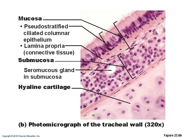 Mucosa • Pseudostratified ciliated columnar epithelium • Lamina propria (connective tissue) Submucosa Seromucous gland