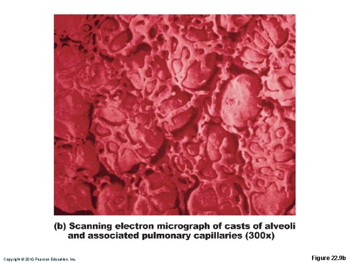 Copyright © 2010 Pearson Education, Inc. Figure 22. 9 b Copyright © 2010 Pearson Education, Inc. Figure 22. 9 b