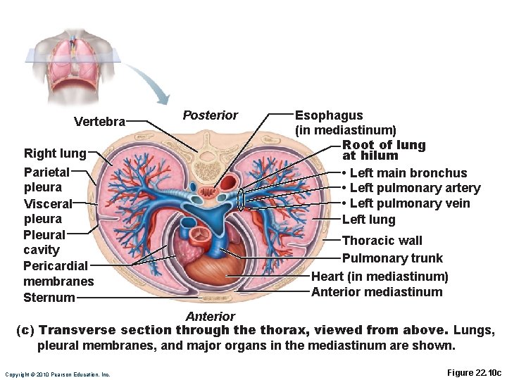 Vertebra Right lung Parietal pleura Visceral pleura Pleural cavity Pericardial membranes Sternum Posterior Esophagus Vertebra Right lung Parietal pleura Visceral pleura Pleural cavity Pericardial membranes Sternum Posterior Esophagus
