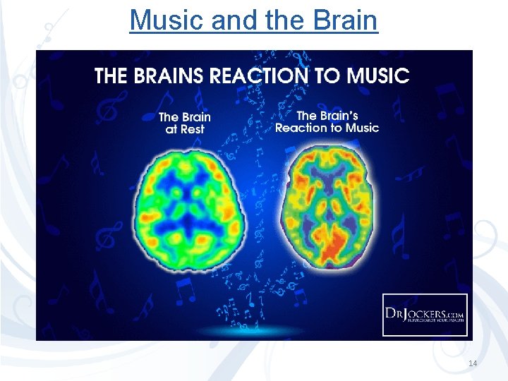 Music and the Brain 14 