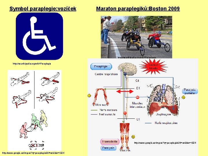 Symbol paraplegie: vozíček Maraton paraplegiků: Boston 2009 http: //cs. wikipedia. org/wiki/Paraplegie http: //www. google.