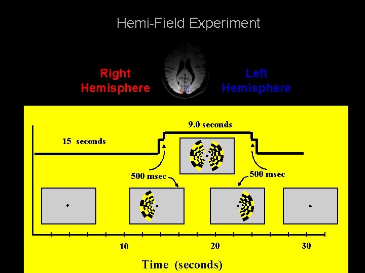 Hemi-Field Experiment Right Hemisphere Left Hemisphere 9. 0 seconds 15 seconds 500 msec 10