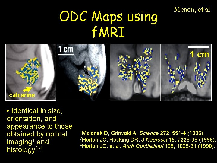 ODC Maps using f. MRI Menon, et al 1 cm calcarine • Identical in