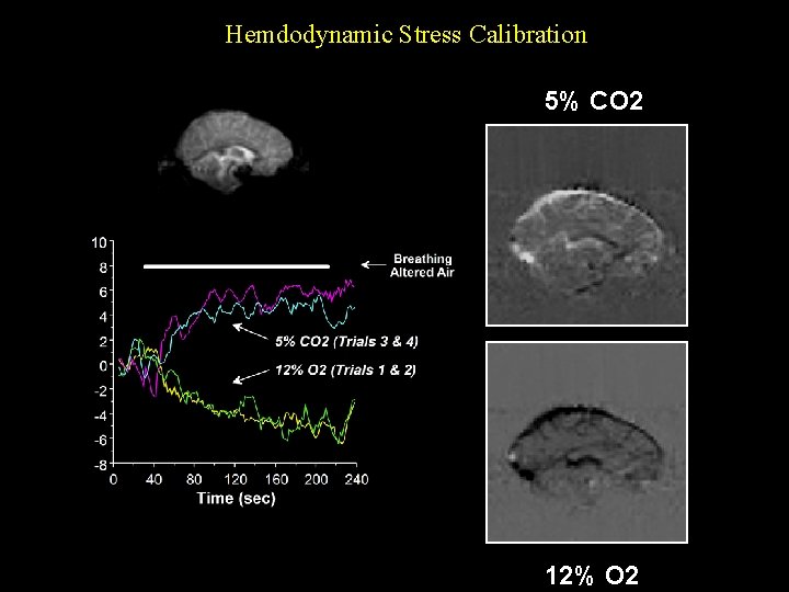 Hemdodynamic Stress Calibration 5% CO 2 12% O 2 