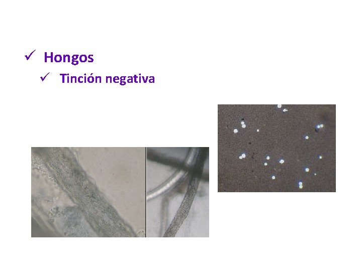 ü Hongos ü Tinción negativa 