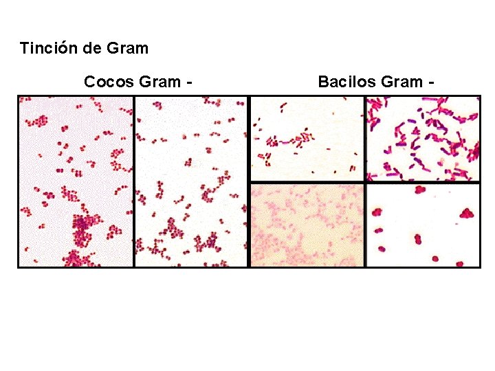 Lunes Tinción de Gram Cocos Gram - Bacilos Gram - 