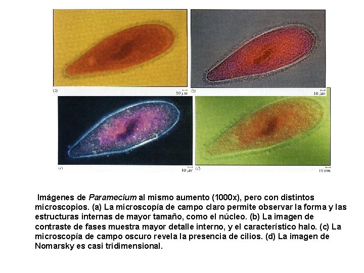  Imágenes de Paramecium al mismo aumento (1000 x), pero con distintos microscopios. (a)