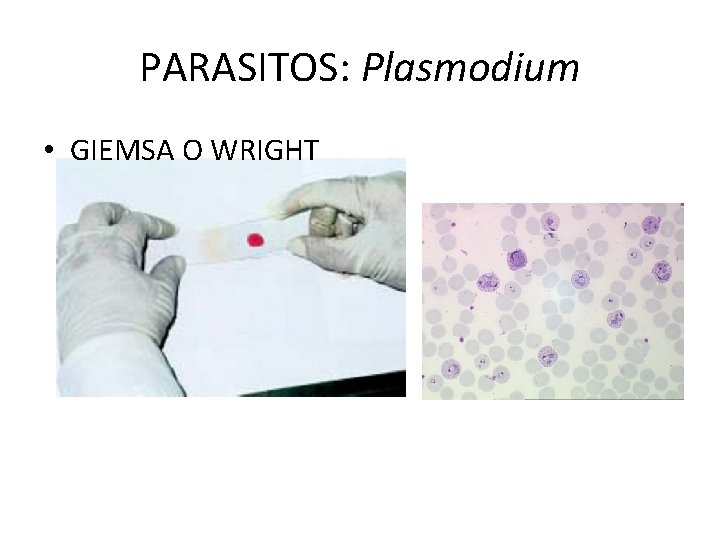 PARASITOS: Plasmodium • GIEMSA O WRIGHT 