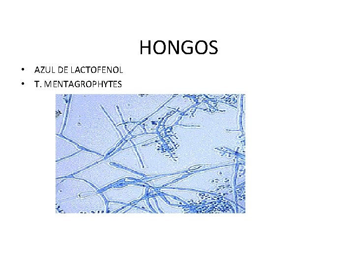 HONGOS • AZUL DE LACTOFENOL • T. MENTAGROPHYTES 