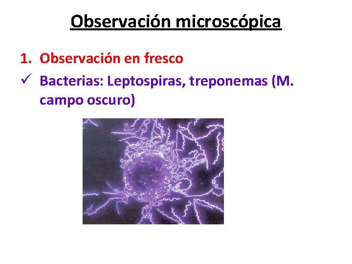 Observación microscópica 1. Observación en fresco ü Bacterias: Leptospiras, treponemas (M. campo oscuro) 