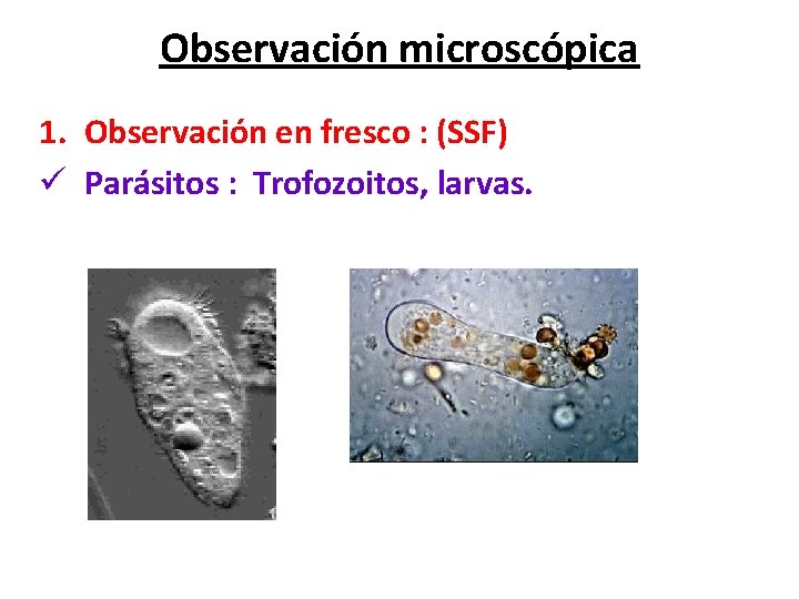 Observación microscópica 1. Observación en fresco : (SSF) ü Parásitos : Trofozoitos, larvas. 