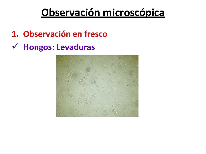 Observación microscópica 1. Observación en fresco ü Hongos: Levaduras 