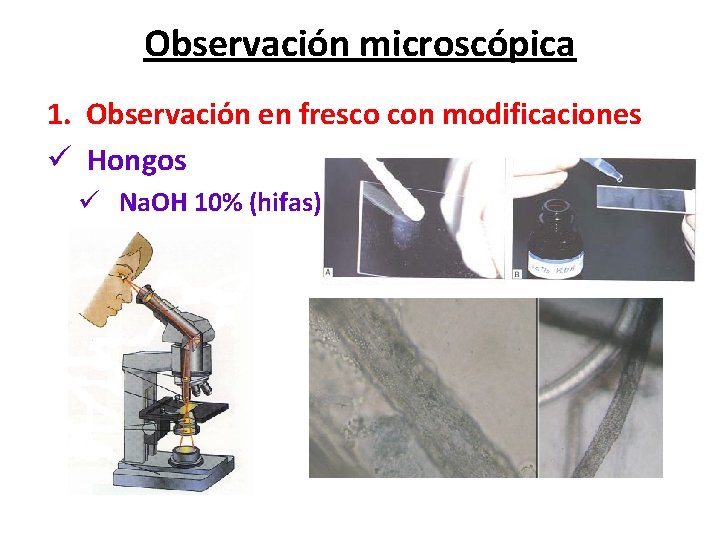 Observación microscópica 1. Observación en fresco con modificaciones ü Hongos ü Na. OH 10%