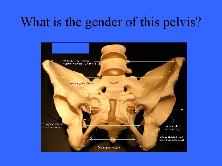 What is the gender of this pelvis? 