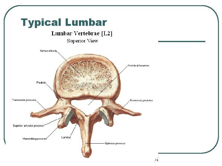 Typical Lumbar 