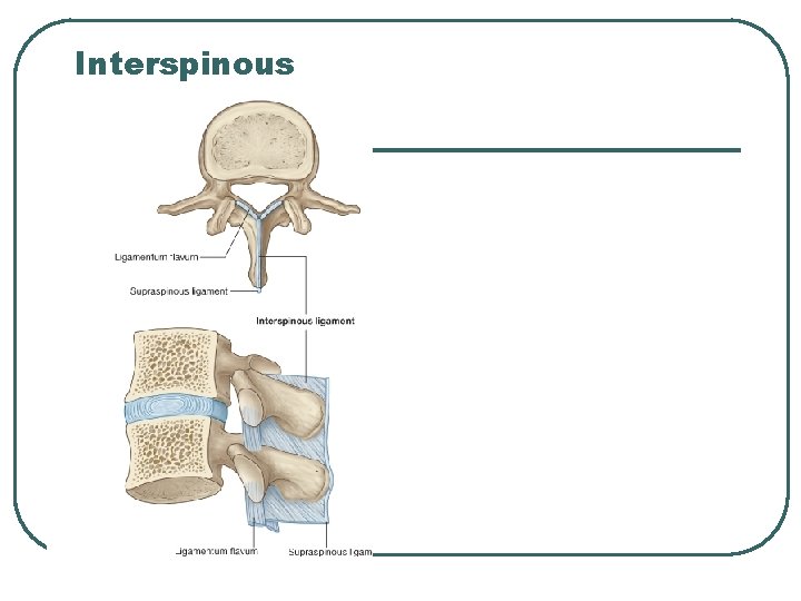 Interspinous 