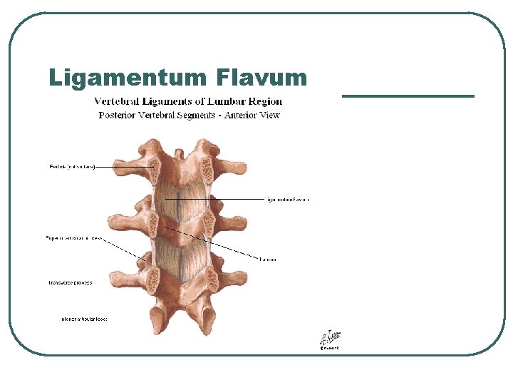 Ligamentum Flavum 
