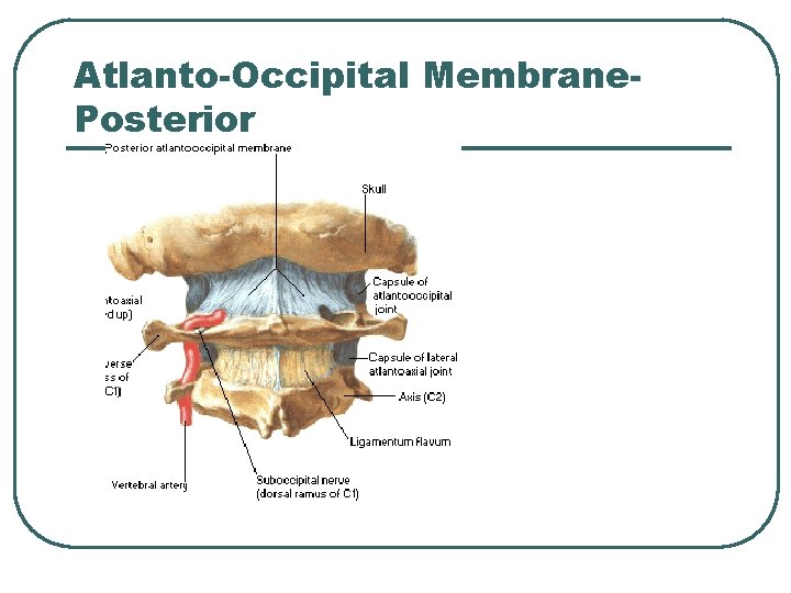 Atlanto-Occipital Membrane. Posterior 