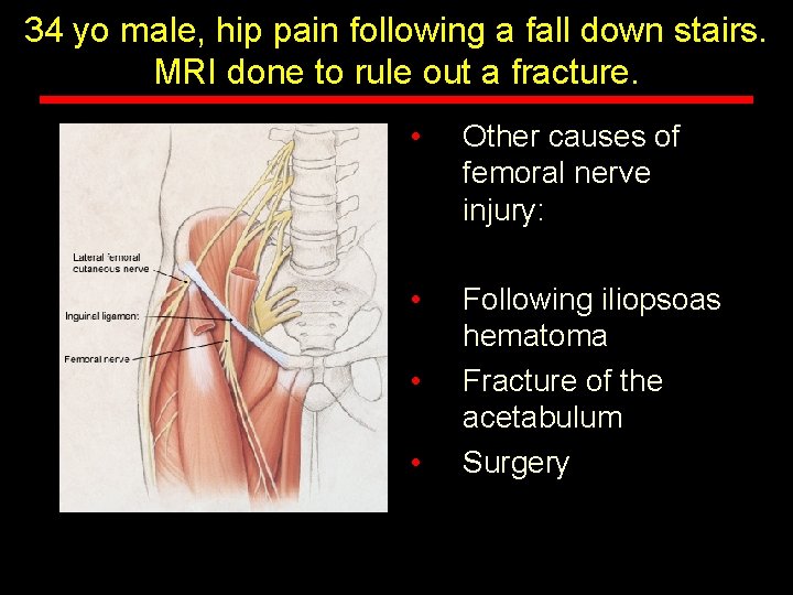 34 yo male, hip pain following a fall down stairs. MRI done to rule