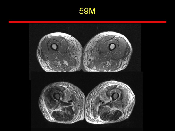 59 M 