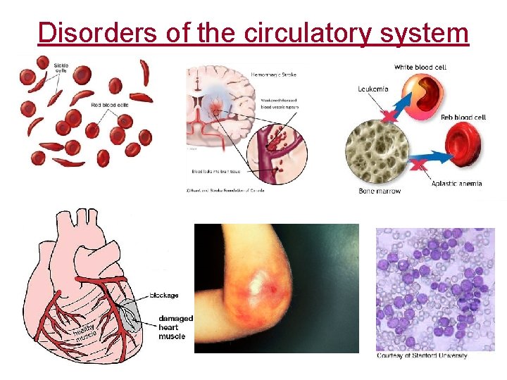 Disorders of the circulatory system 