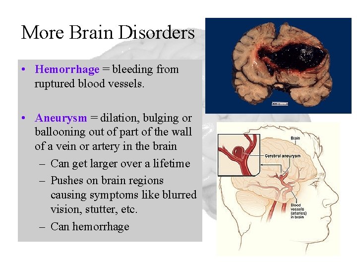 More Brain Disorders • Hemorrhage = bleeding from ruptured blood vessels. • Aneurysm =