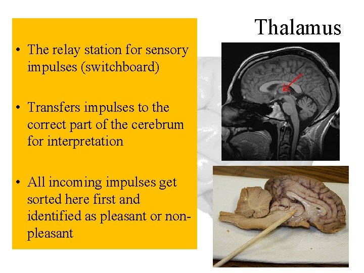 Thalamus • The relay station for sensory impulses (switchboard) • Transfers impulses to the