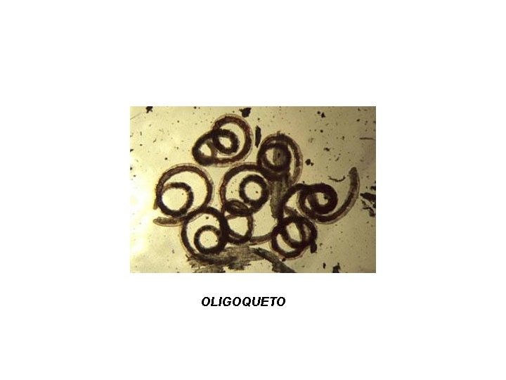 OLIGOQUETO 
