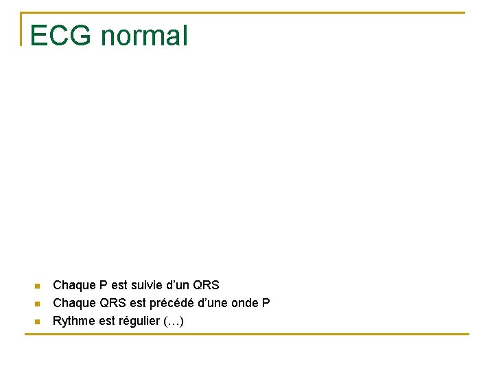 ECG normal n n n Chaque P est suivie d’un QRS Chaque QRS est