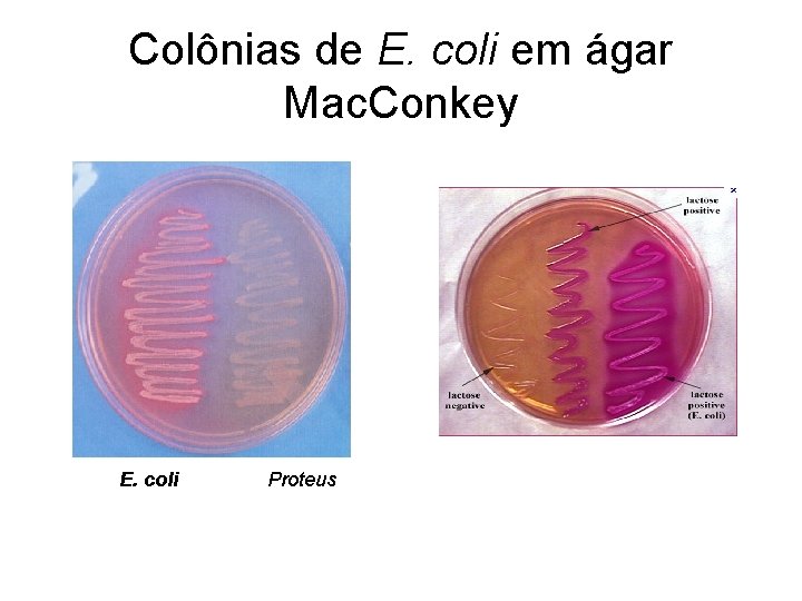 Colônias de E. coli em ágar Mac. Conkey E. coli Proteus 