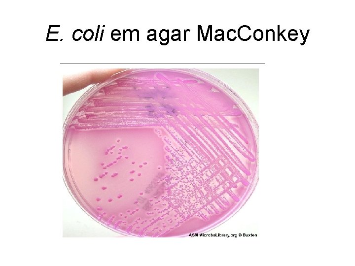 E. coli em agar Mac. Conkey E. coli em agar Mac. Conkey