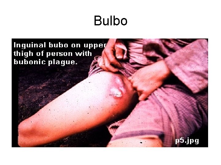 Bulbo Bulbo