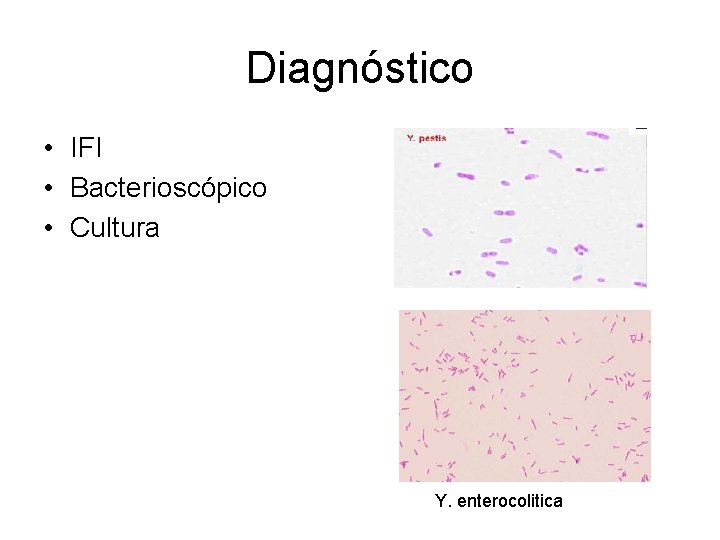 Diagnóstico • IFI • Bacterioscópico • Cultura Y. enterocolitica Diagnóstico • IFI • Bacterioscópico • Cultura Y. enterocolitica