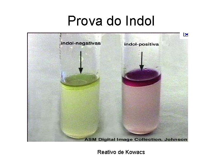 Prova do Indol Reativo de Kowacs Prova do Indol Reativo de Kowacs