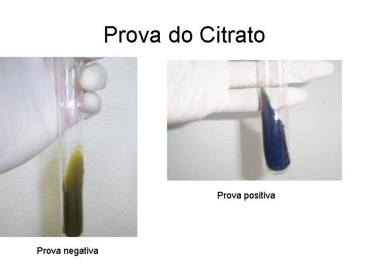 Prova do Citrato Prova positiva Prova negativa Prova do Citrato Prova positiva Prova negativa