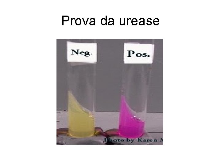 Prova da urease Prova da urease