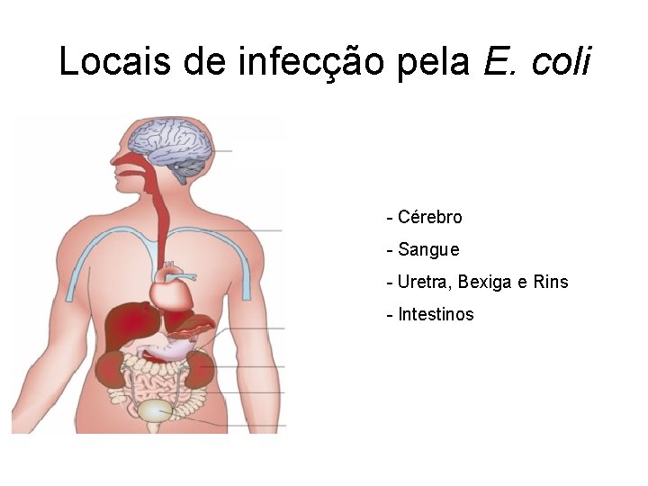 Locais de infecção pela E. coli - Cérebro - Sangue - Uretra, Bexiga e