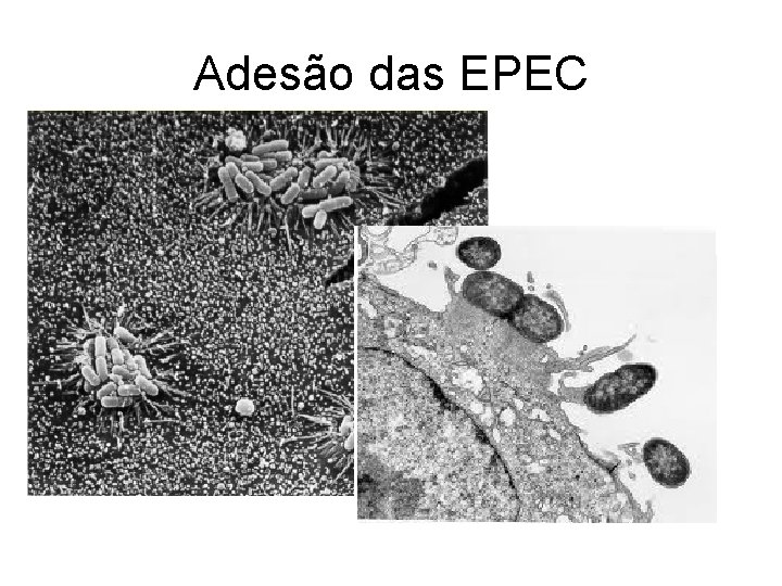 Adesão das EPEC Adesão das EPEC
