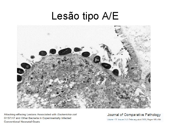 Lesão tipo A/E Lesão tipo A/E