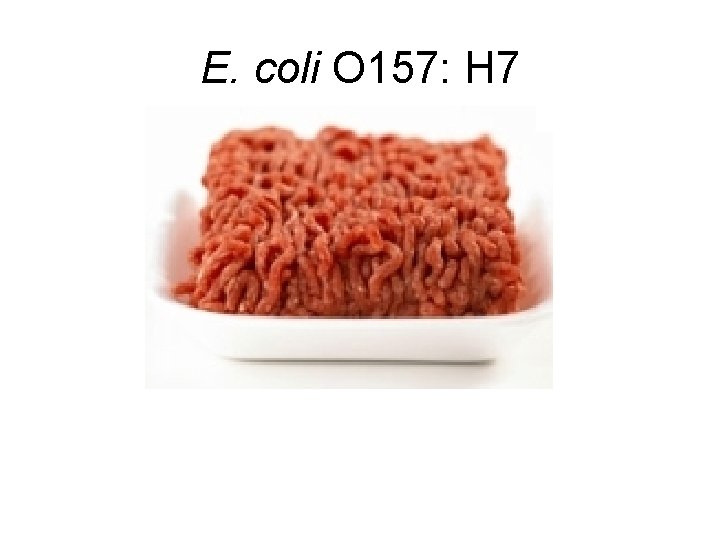 E. coli O 157: H 7 