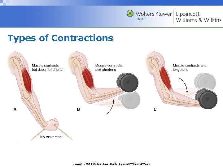 Types of Contractions Copyright © 2014 Wolters Kluwer Health | Lippincott Williams & Wilkins