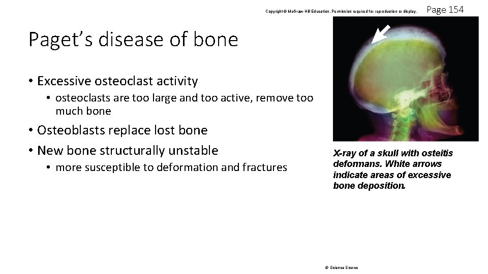 Copyright © Mc. Graw-Hill Education. Permission required for reproduction or display. Page 154 Paget’s