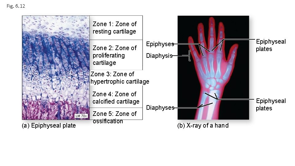 Fig. 6. 12 Zone 1: Zone of resting cartilage Zone 2: Zone of proliferating