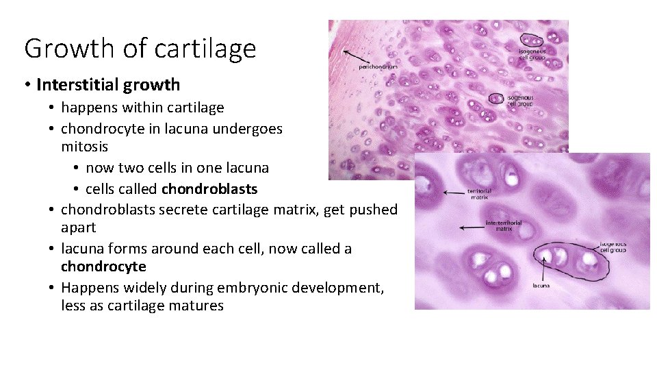 Growth of cartilage • Interstitial growth • happens within cartilage • chondrocyte in lacuna Growth of cartilage • Interstitial growth • happens within cartilage • chondrocyte in lacuna