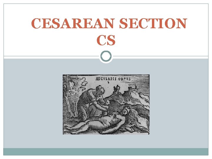 CESAREAN SECTION CS 