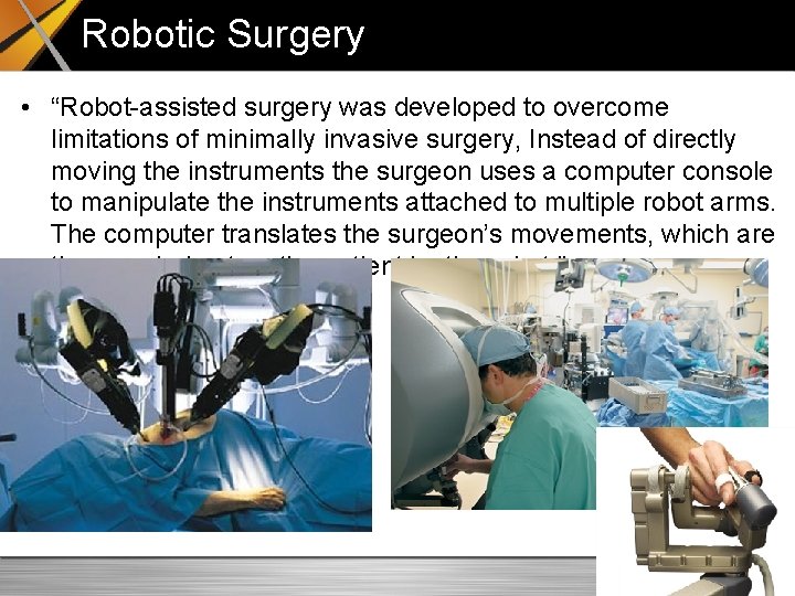 Robotic Surgery • “Robot-assisted surgery was developed to overcome limitations of minimally invasive surgery,