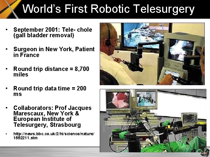 World’s First Robotic Telesurgery • September 2001: Tele- chole (gall bladder removal) • Surgeon