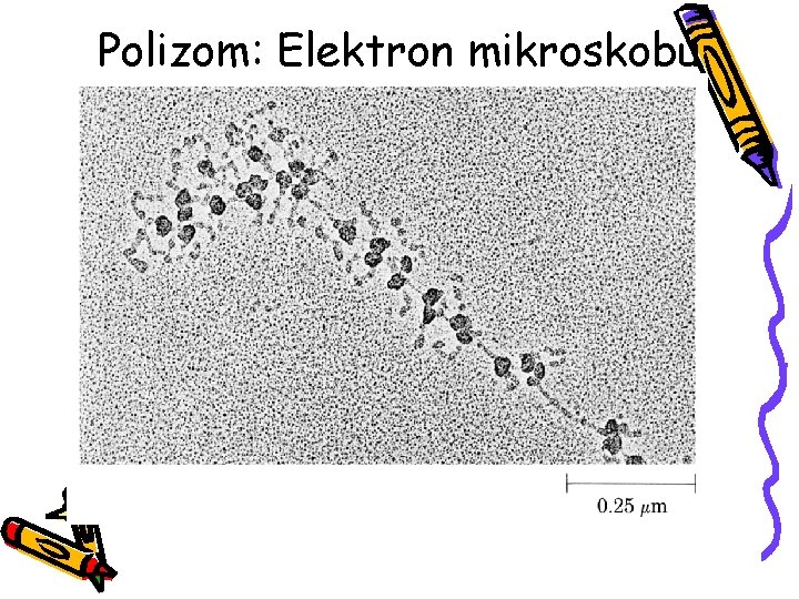 Polizom: Elektron mikroskobu 